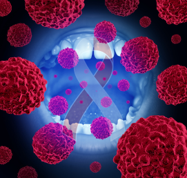 ক্যান্সারের চিকিৎসায় প্রাথমিক সনাক্তকরণ গুরুত্বপূর্ণ। সার্জারি, কেমোথেরাপি বা রেডিয়েশন থেরাপির
                        মাধ্যমে এটি নিরাময় সম্ভব, তবে জীবনধারা পরিবর্তন ও সময়মতো চিকিৎসা অত্যন্ত জরুরি।