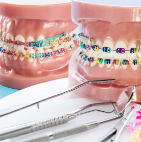The latest treatment for crooked, high, low, and gapped teeth: Braces treatment