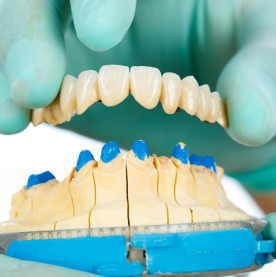 Namira Oro Dental Care offers quality dental bridges for missing tooth restoration