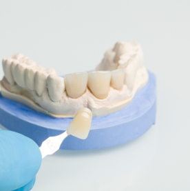Durable dental crowns treatment at Namira Oro Dental Care in Bogura for tooth restoration
